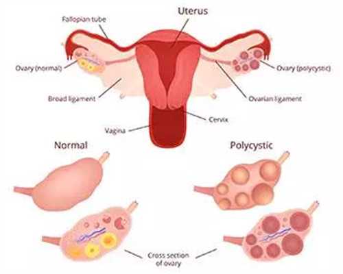 <b>在整个供卵试管过程中，如何从试管婴儿中获得精子？</b>